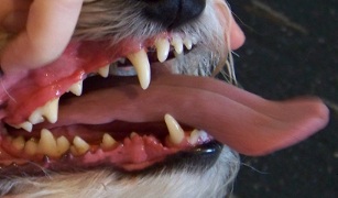 Teeth after cleaning