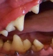 Teeth after cleaning