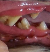 Teeth before cleaning
